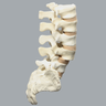 Spine, Lumbar Vertebrae with L4 Spondylolisthesis, Foam Cortical