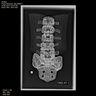 Spine, L1-Sacrum, Lumbar with Muscles, Radiopaque