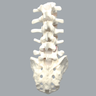 Spine, Lumbar with L4 Spondylolisthesis, Solid Foam