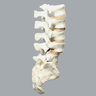 Spine, Lumbar with L4 Spondylolisthesis, Solid Foam