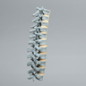 Spine, Lumbar, T7-L5, Osteoporotic Vertebrae, Radiopaque