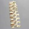 Spine, T9-L4, Foam Cortical