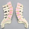 Spine, Lumbar, Cross-Sectioned, Foam Cortical