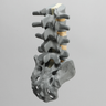 Spine, Lumbar, L2-Sacrum, Radiopaque
