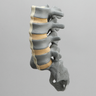 Spine, Lumbar, L2-Sacrum, Radiopaque