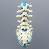 Spine, Lumbar, with L5 Stenosis, Foam Cortical