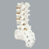 Spine, Lumbar, L1-Sacrum, Foam Cortical Shell