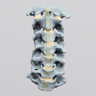 Spine, Cervical , with Anterior Ligament, Radiopaque