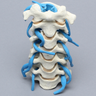 Spine, Cervical, with Nerve Roots, Foam Cortical