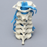Spine, Cervical, with Nerve Roots, Foam Cortical