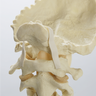 Spine, Cervical, with Occipital, Foam Cortical