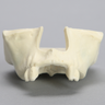Maxilla with Mucosa