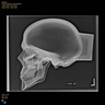 Skull, Full, Radiopaque, With Vise Attachment