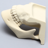 Mandible with Maxilla
