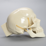 Skull, Full, With Multiple Fractures