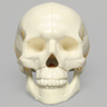 Skull, Full, with All Le Fort Fractures, Solid Foam