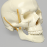 Skull, Full, with All Le Fort Fractures, Solid Foam