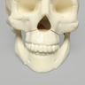 Skull, Full, with All Le Fort Fractures, Solid Foam