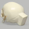 Skull, Full, with All Le Fort Fractures, Solid Foam