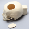 Skull with Craniotomy without Mandible