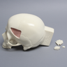 Skull with Fracture and Craniotomies