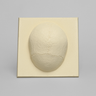 Skull Cap with Dura and Soft Tissue