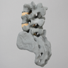 Spine, Lumbar, L3-Sacrum, Radiopaque