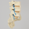 Spine, Lumbar Vertebrae with Nerve Roots and Ligamenta Flava, L3-Sacrum, Solid Foam