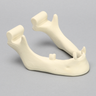 Mandible, Partially Edentulous