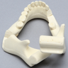 Mandible with Bilateral Fractures
