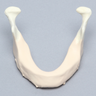 Mandible with Mucosa