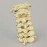 Spine, Cervical without Posterior Ligament, Solid Foam