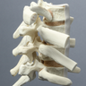 Thoracic Vertebrae with Ribs, Solid Foam