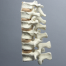 Spine, T9-L2, Foam Cortical Shell