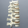 Spine, T9-L2, Foam Cortical Shell