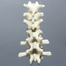 Spine, T9-L2, Foam Cortical Shell