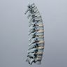 Spine, Thoracic T1-T12, Radiopaque