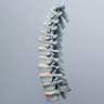 Spine, Thoracic T1-T12, Radiopaque