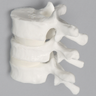 Thoracic Vertebrae, T8-T10, Solid White Plastic