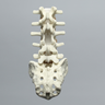 Spine, Lumbar with Laminectomy, Solid Foam