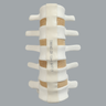 Spine, Lumbar, L1-L5 with Tan Discs, Solid Foam