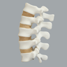 Spine, Lumbar, L1-L5 with Tan Discs, Solid Foam