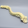 Spine, Scoliosis, C1-Sacrum with 25 Degree Rotation, Solid Foam