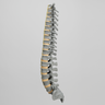 Spine, T1-Sacrum, Radiopaque