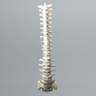 Spine, T1-Sacrum, Solid Foam