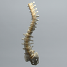 Spine, Scoliosis, T3-Sacrum, Foam Cortical