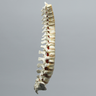 Spine, Scoliosis, T3-Sacrum, Foam Cortical