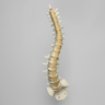 Spine, Scoliosis, T3-Sacrum, Foam Cortical