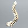 Spine, Scoliosis, T1-Sacrum with 15 degree Rotation, Solid Foam