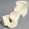 Hemi Pelvis with Segmental Defects, Solid Foam, Left